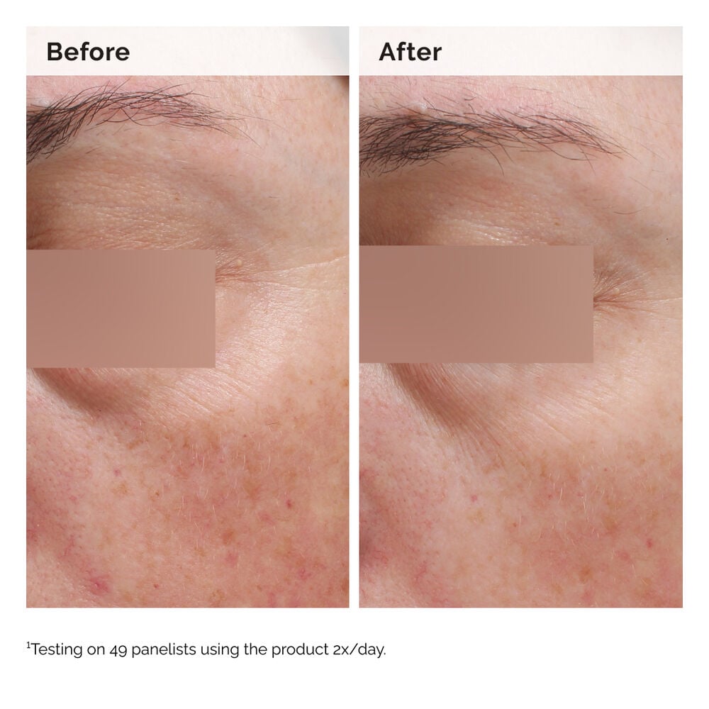 Niacinamide 5% Face and Body Emulsion - Image 3