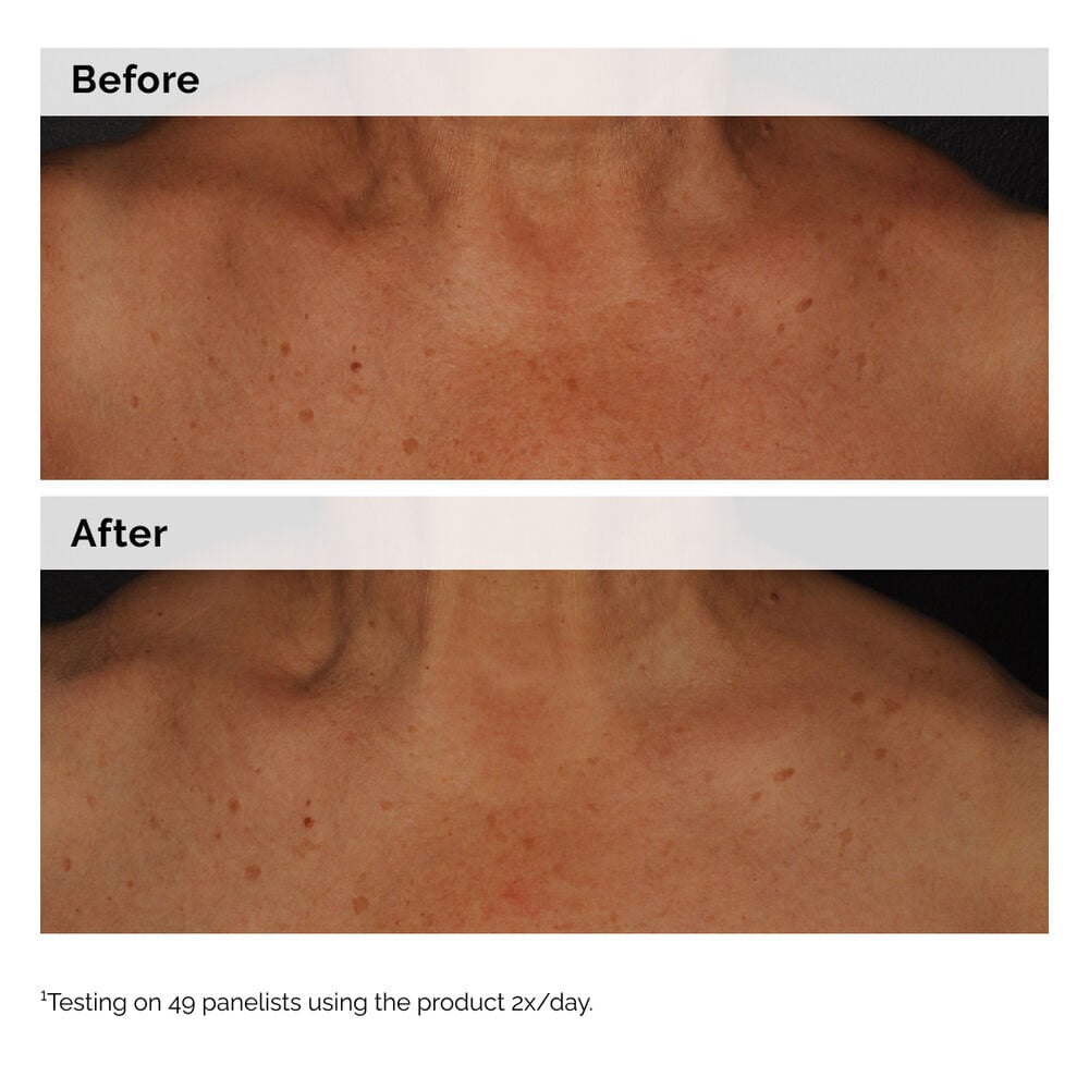 Niacinamide 5% Face and Body Emulsion - Image 2