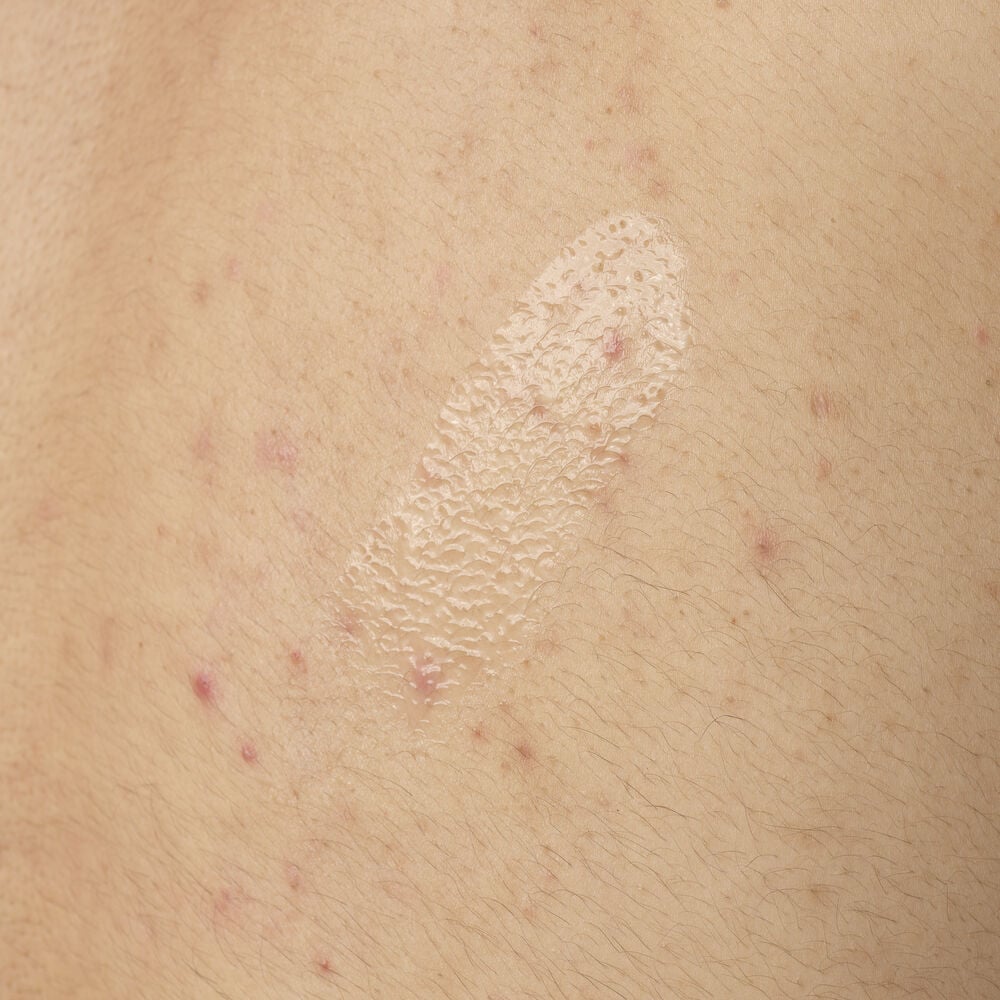 Salicylic Acid 0.5% Body Serum - Image 4